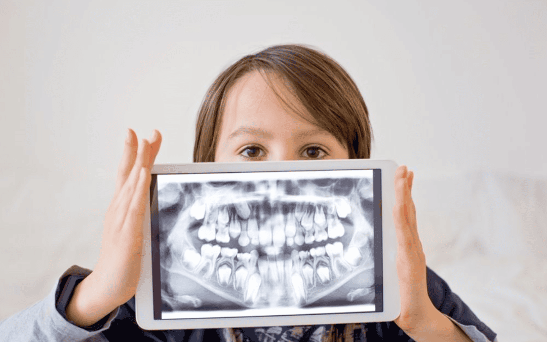 Dental X-rays & Digital Diagnostics at Supreme Multi-Speciality Dental Centre