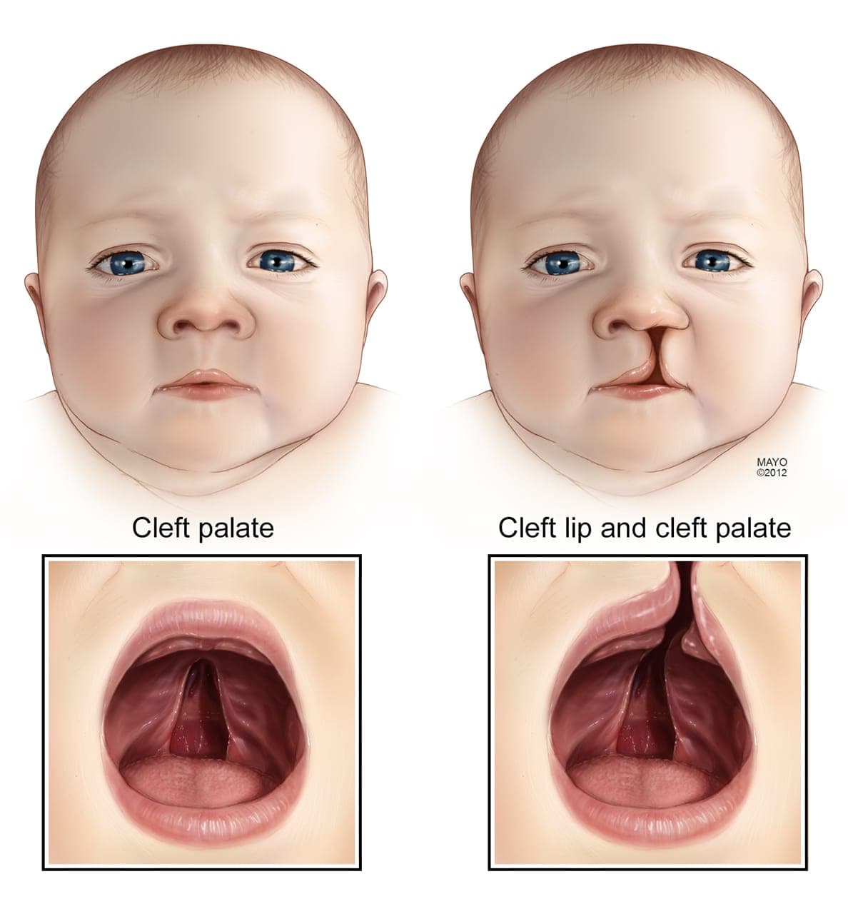Paediatric Dentistry at Supreme Multi-Speciality Dental Centre