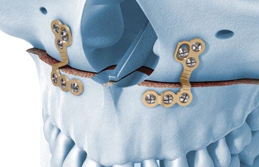 Perfect smile showing healthy teeth
