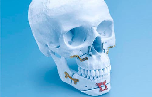 Dental restoration result showcase