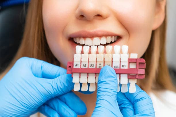 Porcelain Veneers at Supreme Multi-Speciality Dental Centre